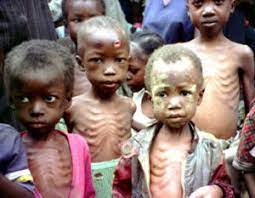 Malnutrition