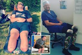 UK-doctor-amputation