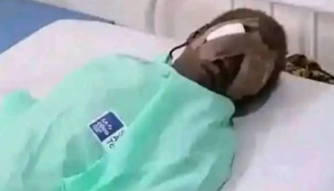 20251017-year-old-boy-in-Bauchi-arrested-for-plucking-out-his-7-year-old-sisters-eyes-for-a-money-ritual-six-suspects-detained