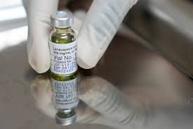NHS-HIV