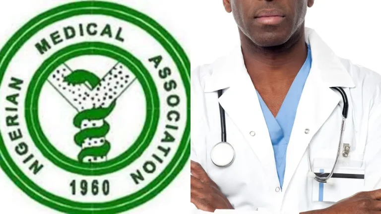 NMA