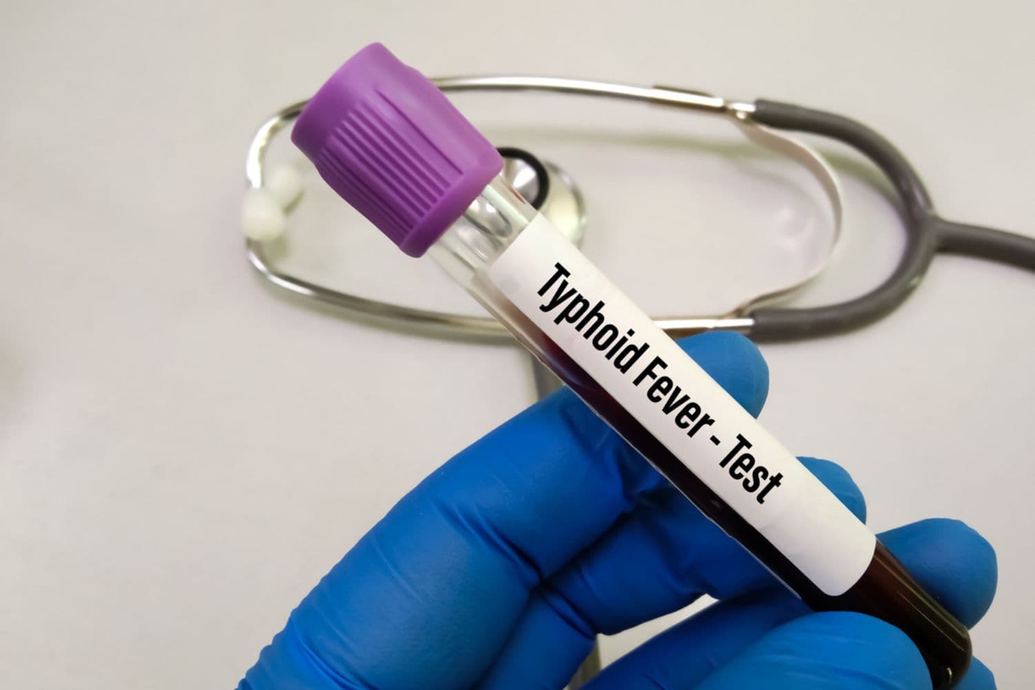 202511Typhoid-Fever
