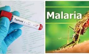 Typhoid-Malaria