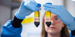 Oxford-univ-Lassa-fever-vaccine