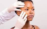 Dermatologist-skin-bleaching