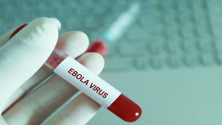 202209Ebola-virus-test