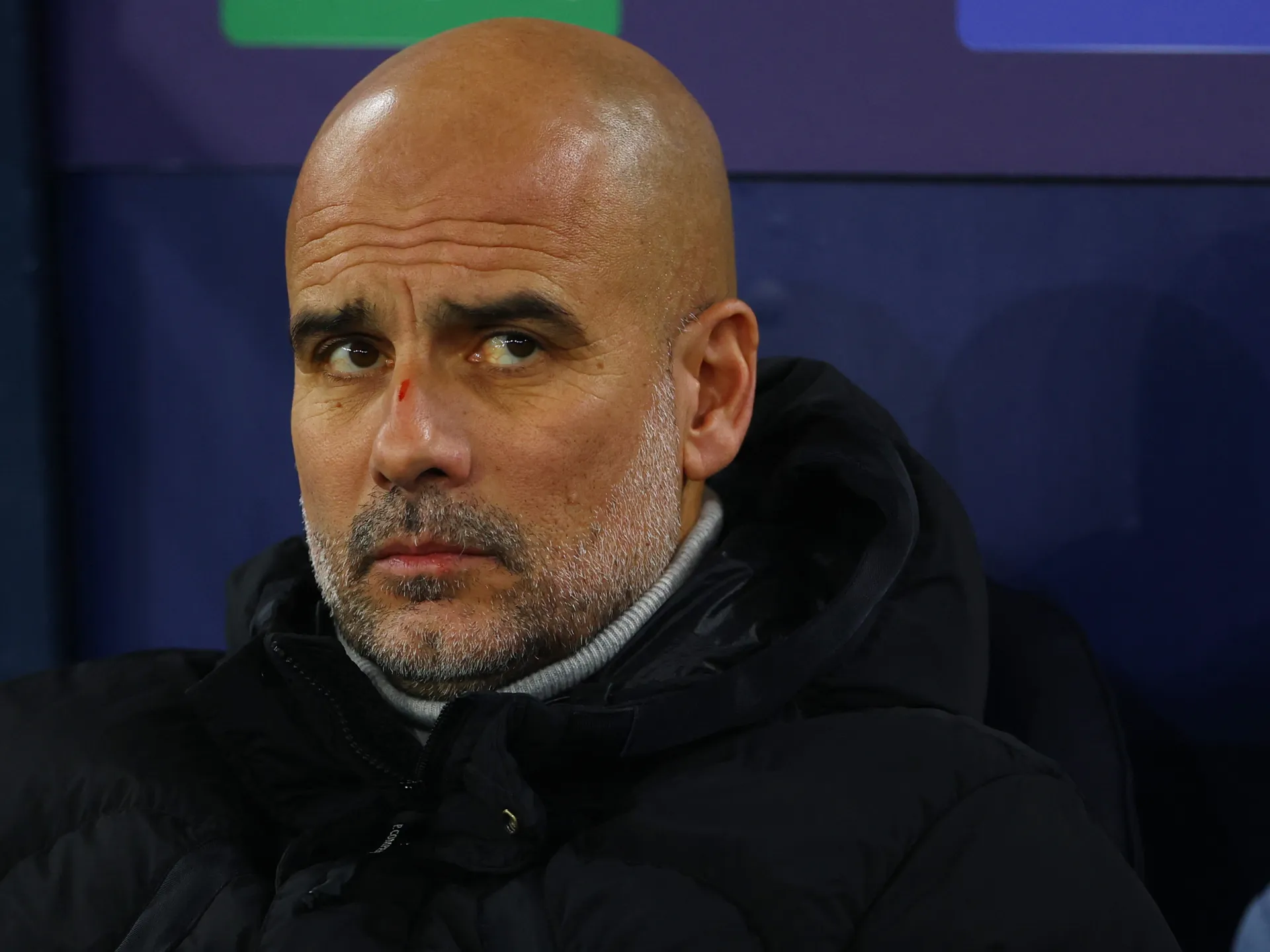 2024-11-26T200229Z_1719908945_UP1EKBQ1JO4BZ_RTRMADP_3_SOCCER-CHAMPIONS-MCI-FEY-REPORT-1732687292-2