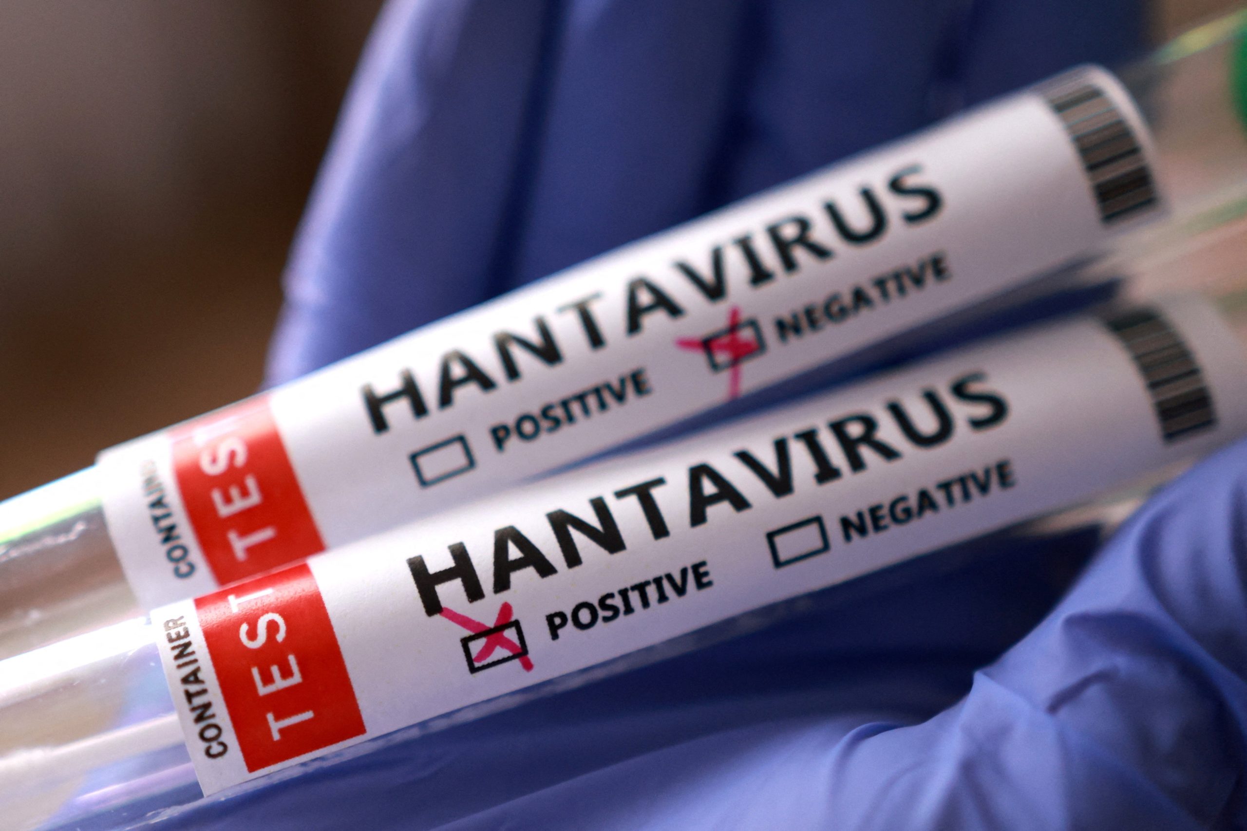 2026052026-05-07T121624Z_1693363317_RC2B4LAFKF62_RTRMADP_3_CRUISESHIP-HANTAVIRUS-scaled-1