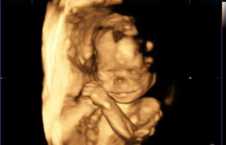 202605Baby-Lumieke