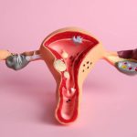 202605HIV-positive-women-fight-for-justice-after-sterilisation