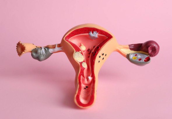 202605HIV-positive-women-fight-for-justice-after-sterilisation