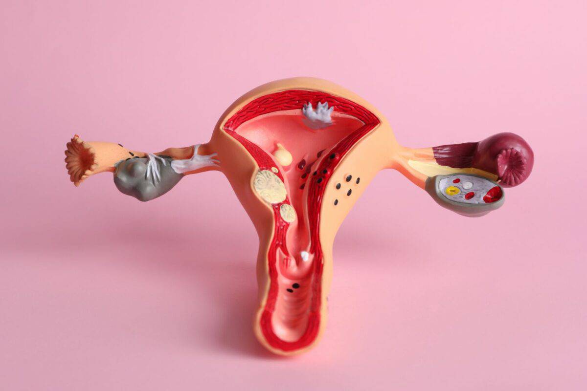 202605HIV-positive-women-fight-for-justice-after-sterilisation