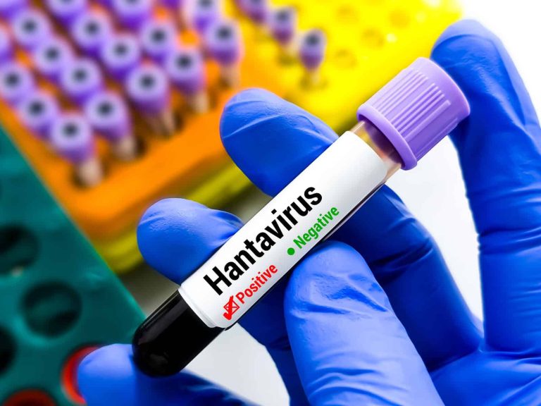 Blood sample for Hantavirus test, Orthohantavirus