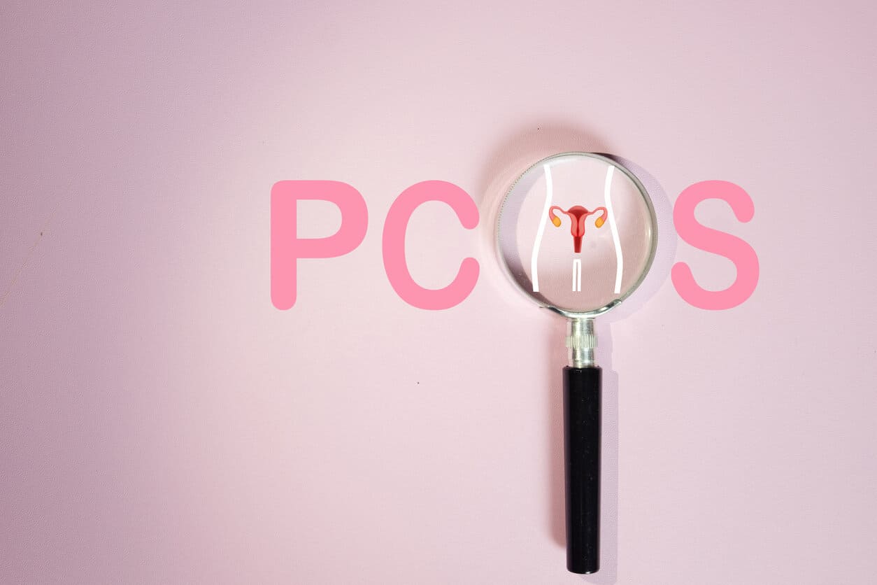 PCOS (Polycystic Ovary Syndrome) diagnosis and awareness concept.