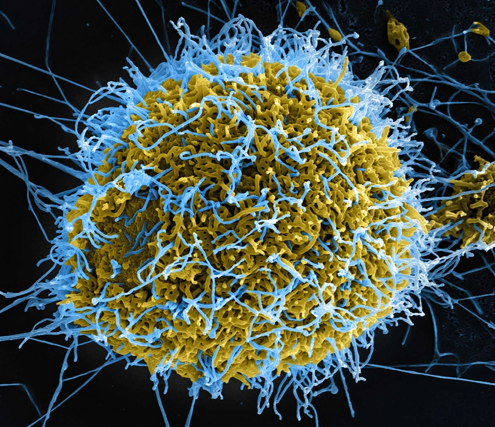 ebola